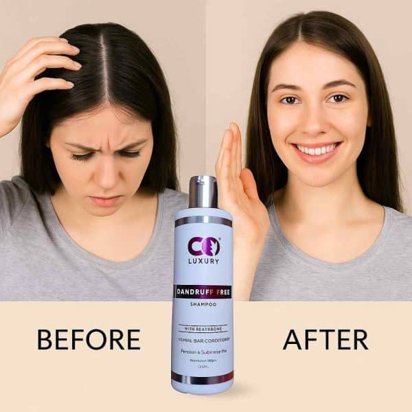 DANDRUFF FREE SHAMPOO | 300ML - Image 2
