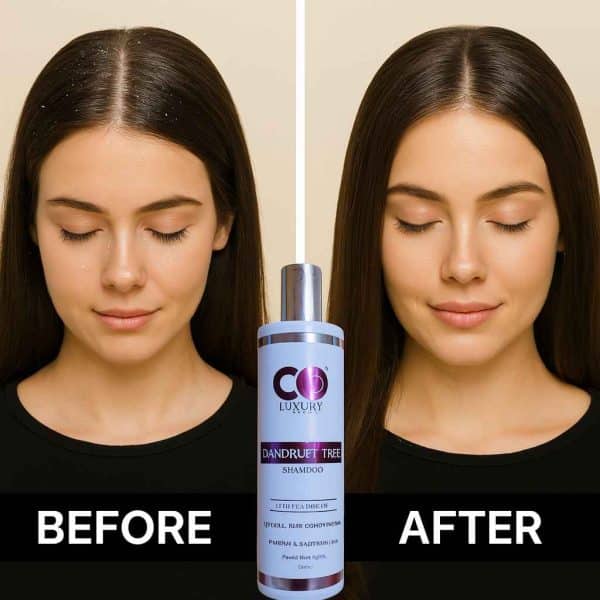 DANDRUFF FREE SHAMPOO | 300ML - Image 4